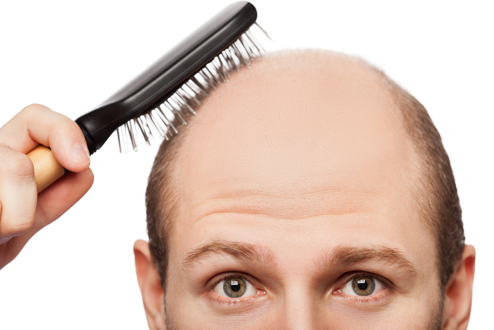 bald man.jpg